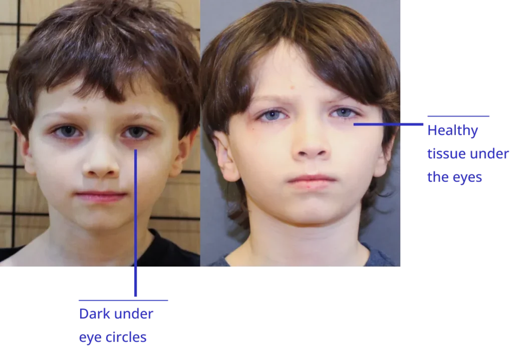 The image shows two photos of a young individual with annotations pointing out their eyes, eyebrows, nose, lips, chin, cheekbones, ears, hair, forehead, and under the chin, labeled 'dark under.