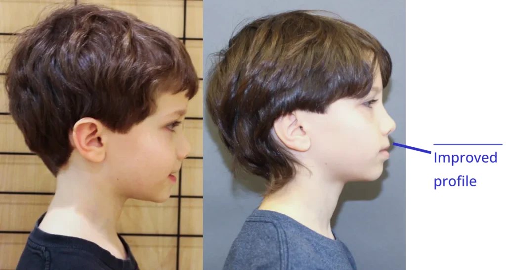 The image shows two side-by-side photographs of a person's head with different hairstyles, likely for comparison purposes.