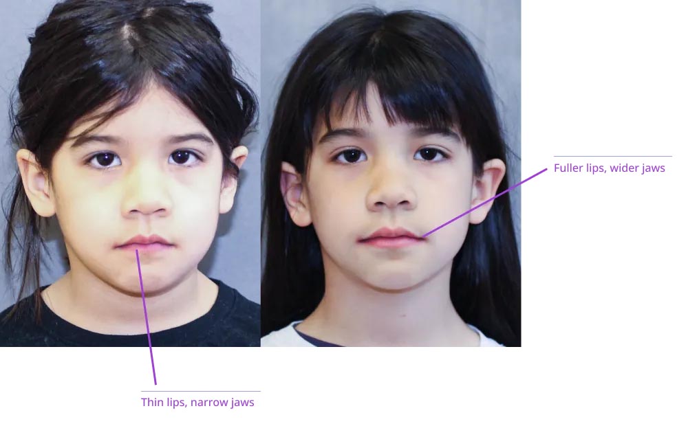 The image displays two side-by-side photographs of a person's face with annotations pointing out facial features such as lips, nose, eyes, and eyebrows.