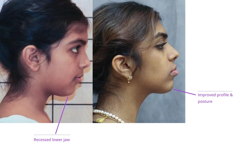 The image shows two photos side by side: on the left is a photo of a young girl with a neutral expression, and on the right is a photo of an adult woman with a neutral expression. Both individuals appear to be looking directly at the camera.