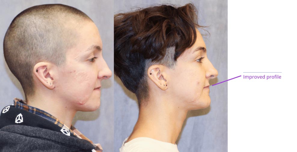 The image displays two side-by-side photographs of an individual before and after a haircut, with annotations highlighting the transformation.