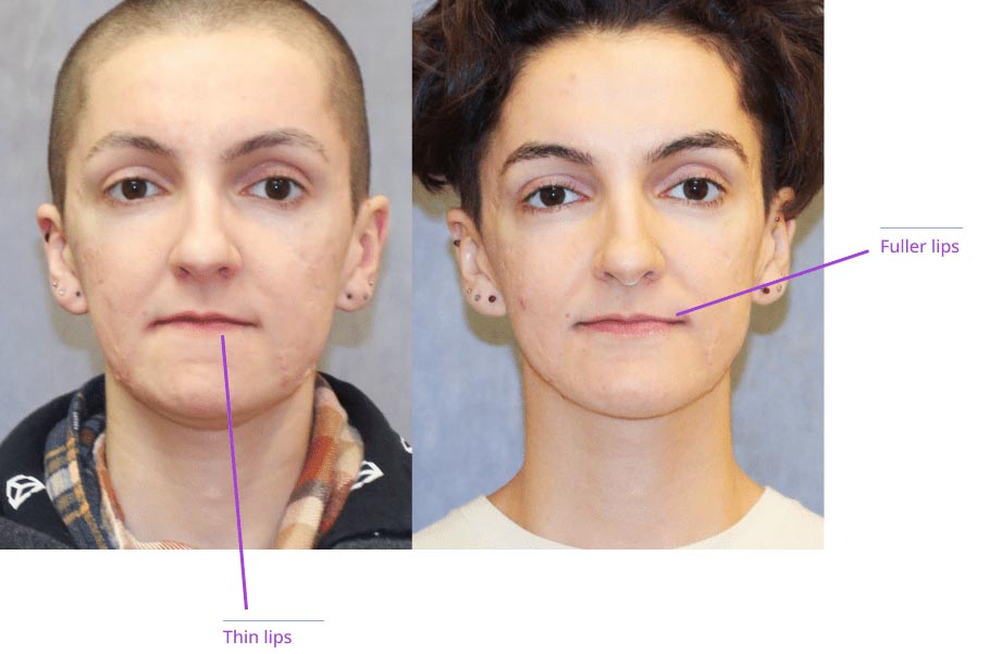 The image shows two close-up photographs of individuals with different hairstyles, labeled with arrows pointing to specific features such as 'full lips' and 'thin lips.