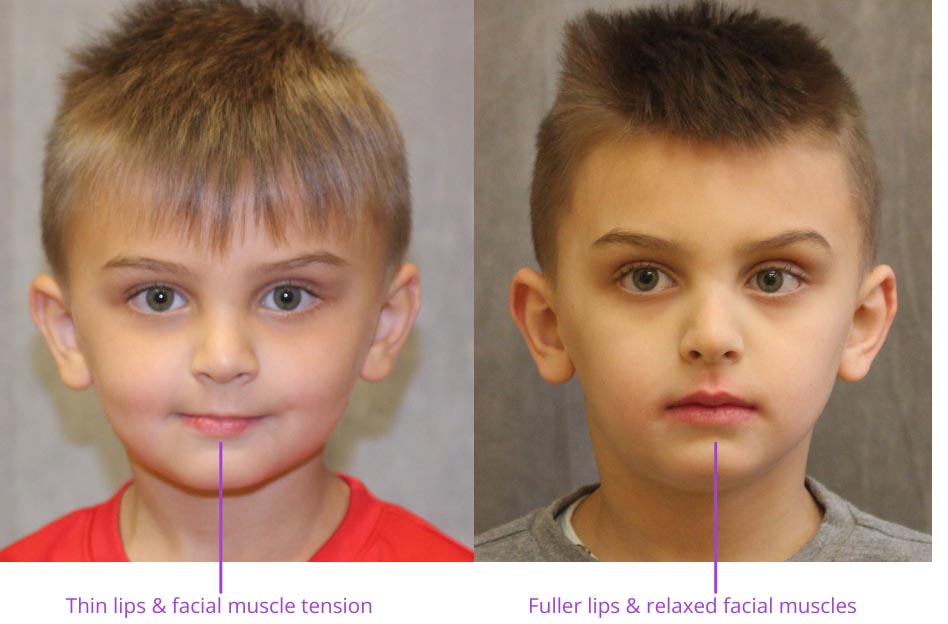 Growing Faces Pediatric Dentistry