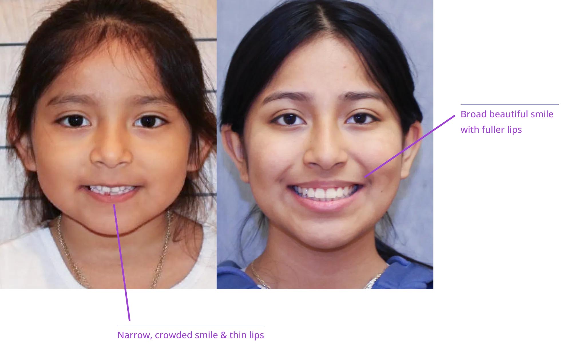 The image shows two close-up photos of a person's face with annotations indicating facial features such as eyebrows, eyes, nose, mouth, chin, neck, and shoulders.