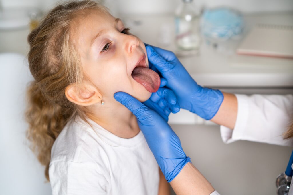 tongue tie release for children