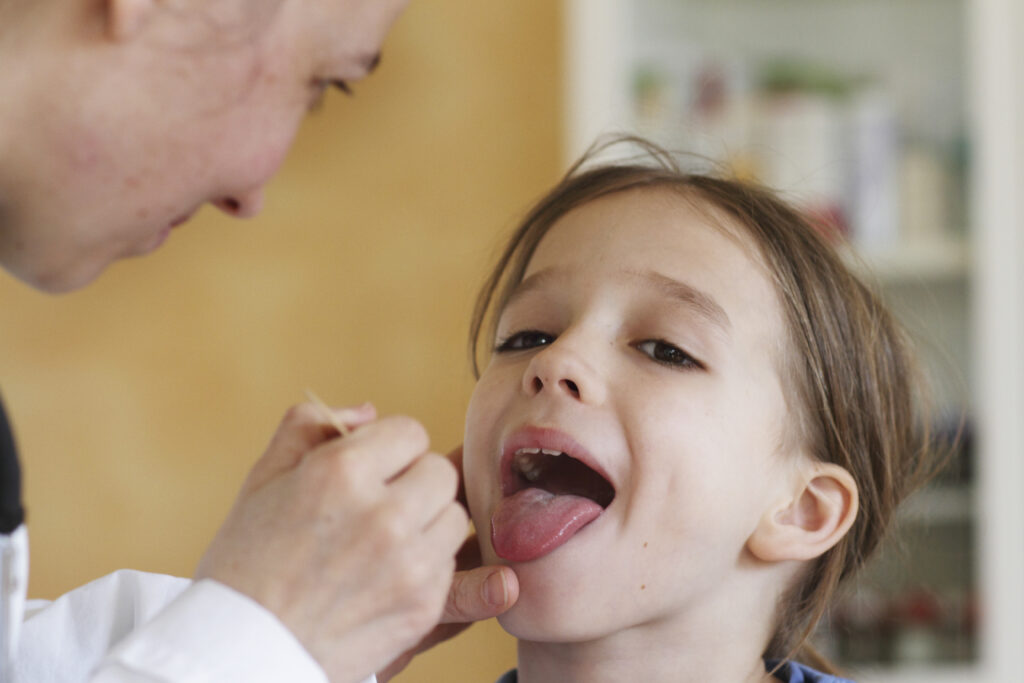 doctor checking tongue tie in child